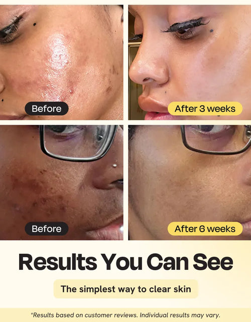 Load image into Gallery viewer, Jumbo Vitamin C Clay Mask
